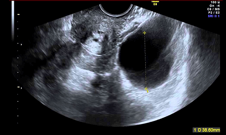 servicio de ultrasonido de pelvis